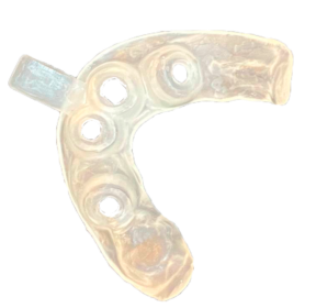 INDIVIDUAL IMPRESSION TRAY